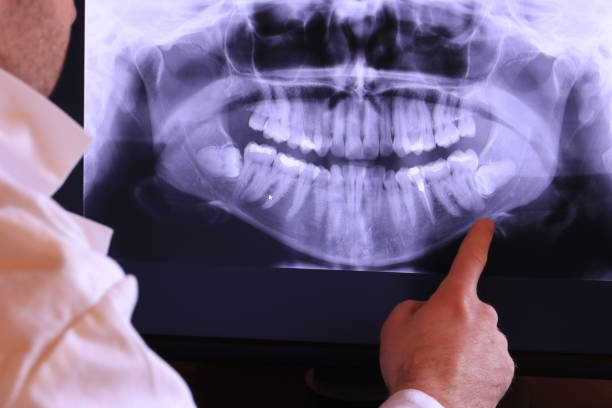 Best Emergency Dentist for Knocked-Out Tooth in Gridley, IL