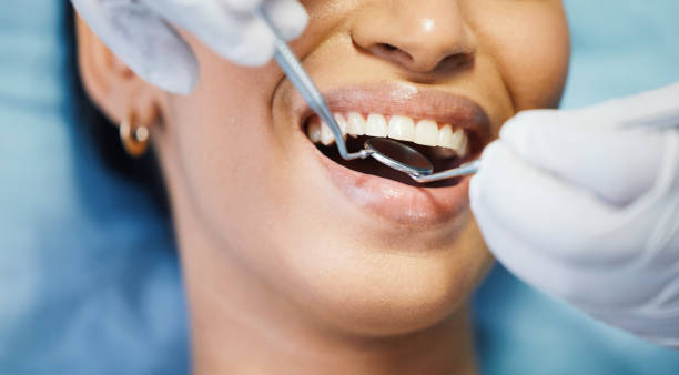 Best Emergency Dentist for Lost Fillings or Crowns in Gridley, IL