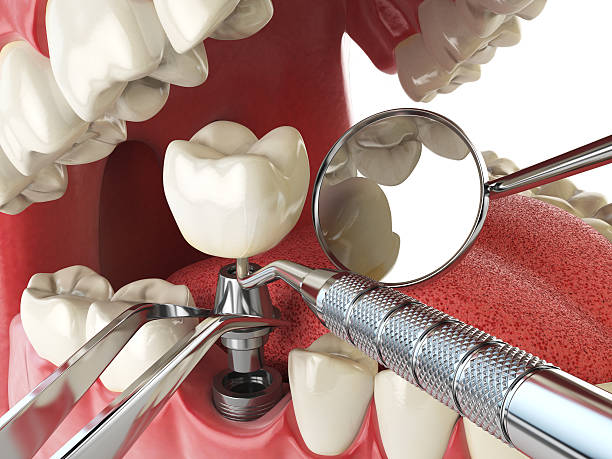 Best Holiday Emergency Dentist in Gridley, IL